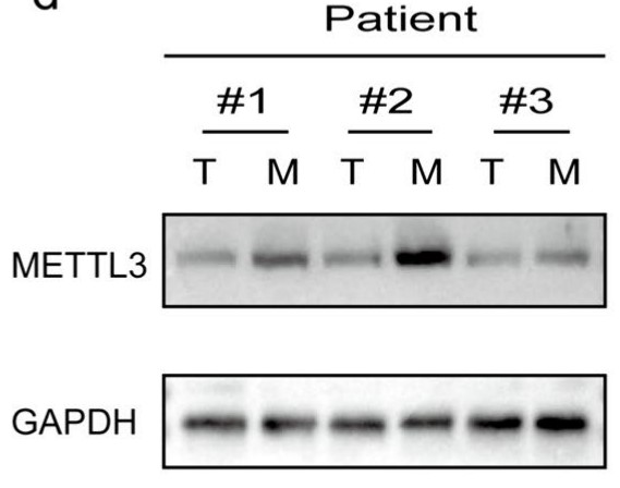 Western blotting analysis of METTL3 protein expression.jpg